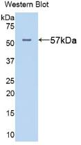 Polyclonal Antibody to Alanine Aminotransferase (ALT)