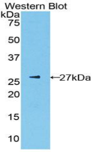 Polyclonal Antibody to Pyruvate kinase isozymes R/L (PKLR)