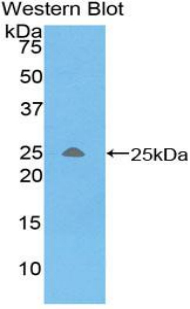 Polyclonal Antibody to Triggering Receptor Expressed On Myeloid Cells 1 (TREM1)