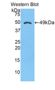 Polyclonal Antibody to Alpha-1-Microglobulin (a1M)