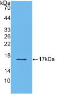 Polyclonal Antibody to Transforming Growth Factor Beta 2 (TGFb2)