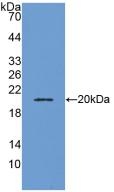 Polyclonal Antibody to Adrenomedullin (ADM)