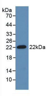 Polyclonal Antibody to Adrenomedullin (ADM)