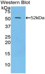 PAA222Hu01.jpg