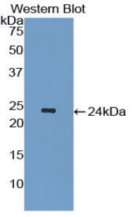 Polyclonal Antibody to Interleukin 1 Receptor Antagonist (IL1RA)