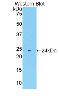 Polyclonal Antibody to Matrix Metalloproteinase 11 (MMP11)