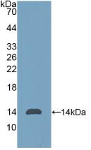 Polyclonal Antibody to Anti-Mullerian Hormone (AMH)