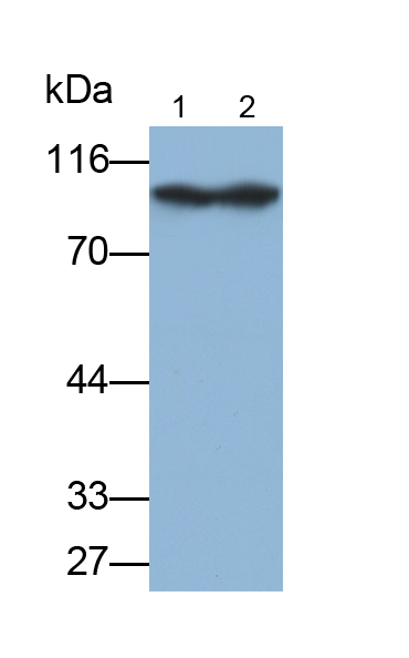 Polyclonal Antibody to Complement 1 Inhibitor (C1INH)