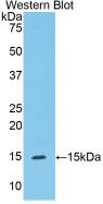 Polyclonal Antibody to Complement 1 Inhibitor (C1INH)