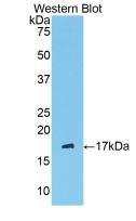 Polyclonal Antibody to Complement 1 Inhibitor (C1INH)