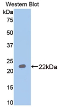 Polyclonal Antibody to Paraoxonase 1 (PON1)