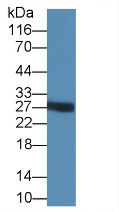 Polyclonal Antibody to Trypsin (TRY)