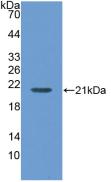 Polyclonal Antibody to Maltase-glucoamylase (MGAM)