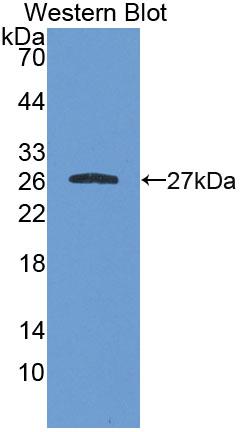 Polyclonal Antibody to N-Acetylgalactosamine-6-Sulfatase (GALNS)