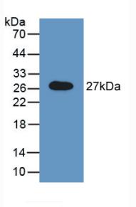 Polyclonal Antibody to N-Acetylgalactosamine-6-Sulfatase (GALNS)