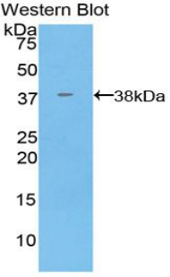 Polyclonal Antibody to Annexin V (ANXA5)