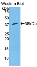 Polyclonal Antibody to Annexin V (ANXA5)