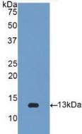 Polyclonal Antibody to Beta-2-Microglobulin (b2M)