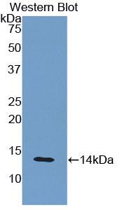 Polyclonal Antibody to Beta-2-Microglobulin (b2M)