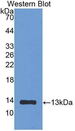Polyclonal Antibody to Beta-2-Microglobulin (b2M)