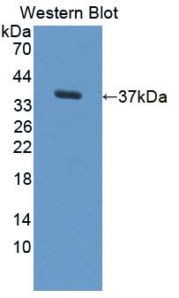 Polyclonal Antibody to Transferrin Receptor 2 (TFR2)