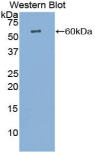 Polyclonal Antibody to Cathepsin K (CTSK)