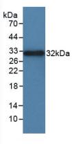 Polyclonal Antibody to Integrin Alpha D (ITGaD)