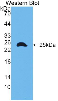 Polyclonal Antibody to Talin 1 (TLN1)