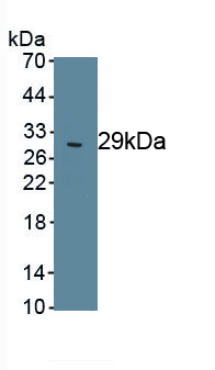 Polyclonal Antibody to Poly ADP Ribose Polymerase (PARP)