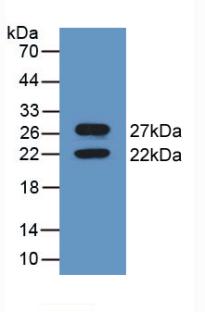 Polyclonal Antibody to Calnexin (CNX)