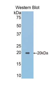 Polyclonal Antibody to Alpha-Fodrin (SPTAN1)