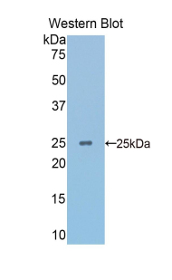 Polyclonal Antibody to Alpha-Fodrin (SPTAN1)