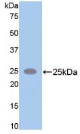 Polyclonal Antibody to Alpha-Fodrin (SPTAN1)