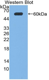 Polyclonal Antibody to Neuronal Pentraxin I (NPTX1)