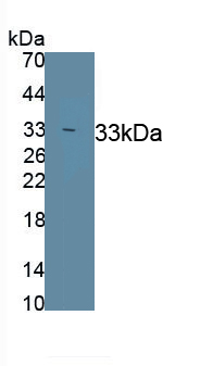 Polyclonal Antibody to Neuronal Pentraxin II (NPTX2)