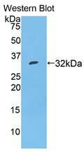 Polyclonal Antibody to Thyroxine Binding Globulin (TBG)