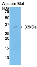 Polyclonal Antibody to Thyroxine Binding Globulin (TBG)