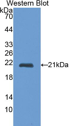 Polyclonal Antibody to Cathepsin L (CTSL)