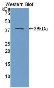 Polyclonal Antibody to Apolipoprotein H (APOH)