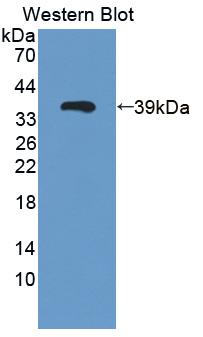 Polyclonal Antibody to Galectin 12 (GAL12)