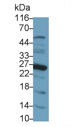 Polyclonal Antibody to Galectin 14 (GAL14)