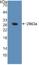 Polyclonal Antibody to Damage Specific DNA Binding Protein 2 (DDB2)