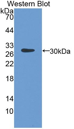 Polyclonal Antibody to Neutrophil Cytosolic Factor 4 (NCF4)