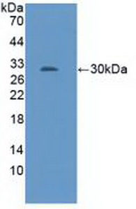 Polyclonal Antibody to Nitric Oxide Synthase 1 Adaptor Protein (NOS1AP)