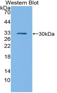 Polyclonal Antibody to GATA Binding Protein 1 (GATA1)