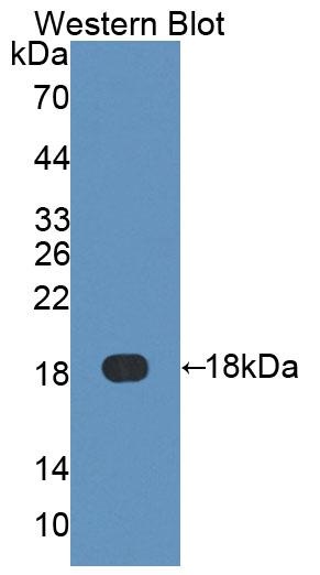 Polyclonal Antibody to Fatty Acid Binding Protein 6, Ileal (FABP6)