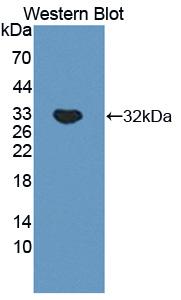 Polyclonal Antibody to Cathepsin A (CTSA)