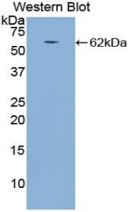 Polyclonal Antibody to Cathepsin A (CTSA)