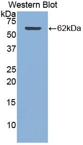 Polyclonal Antibody to Cathepsin A (CTSA)