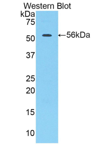 Polyclonal Antibody to Cathepsin A (CTSA)